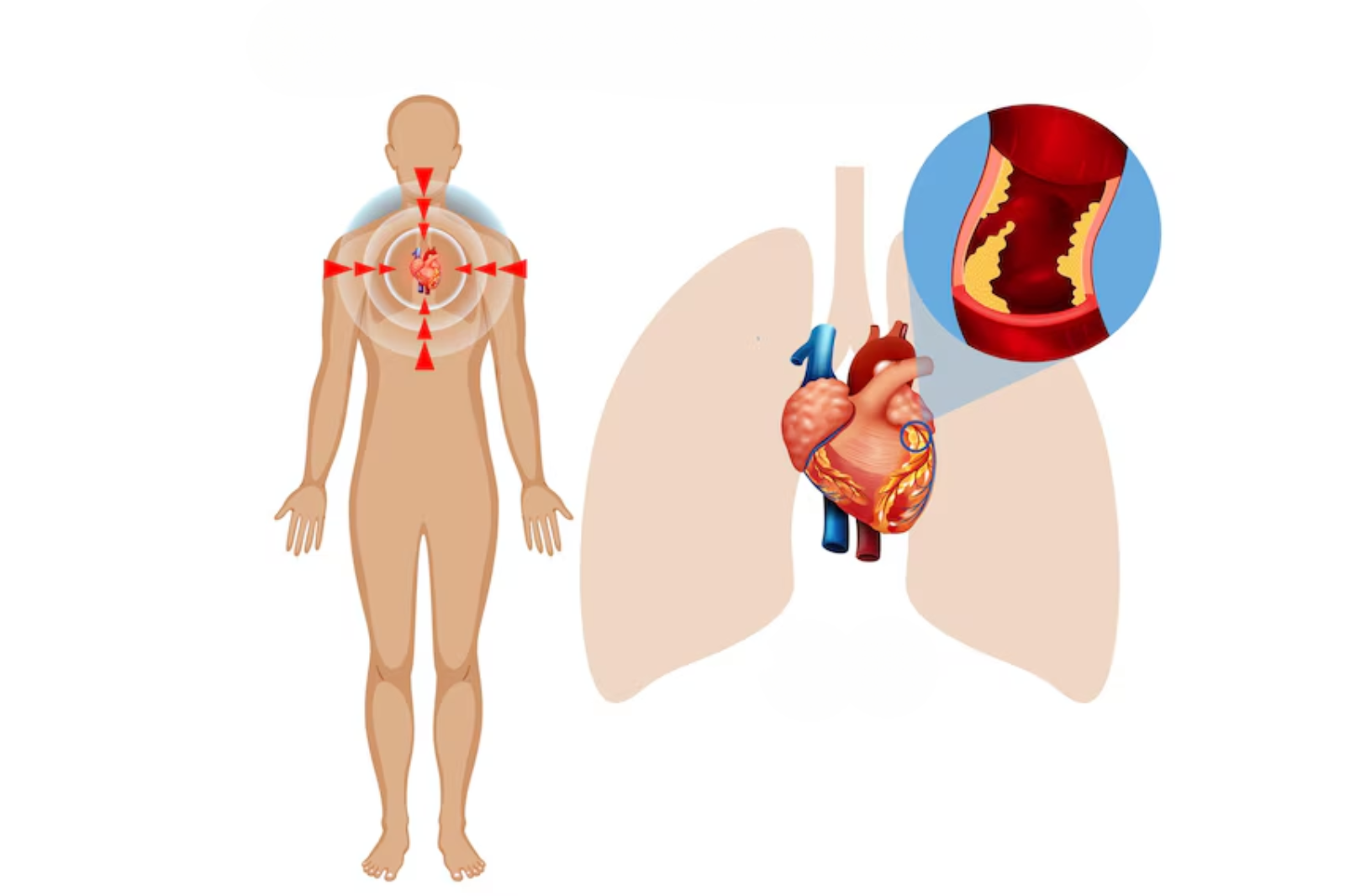 heart doctor in guwahati in guwahati