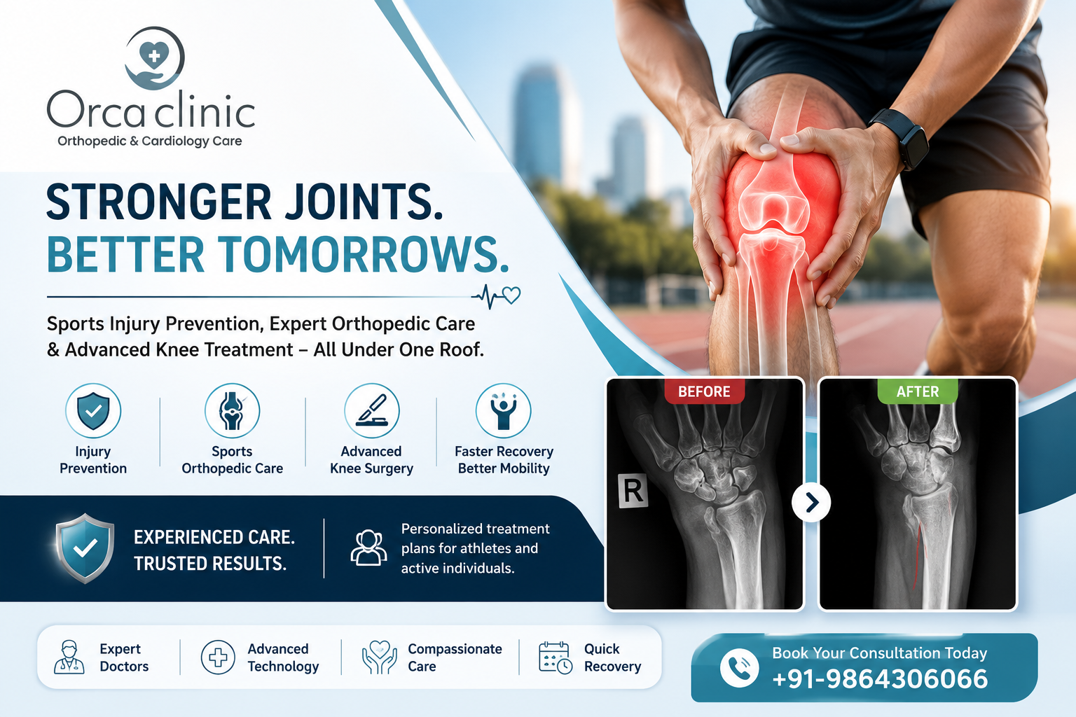 Sports Injury Prevention & Knee Health: What Every Active Person in Guwahati Should Know
